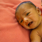 A,Yellow,Skin,Colored,Neonatal,Jaundice,Baby,Crying,In,Pain