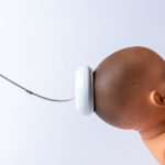 Vacuum,Delivery,Extraction,Pump,,To,Assist,Delivery,Of,A,Baby
